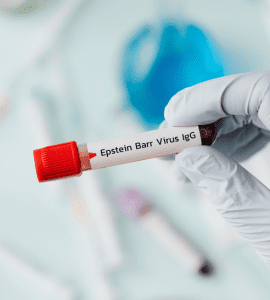 Epstein Barr Virus IgG Antibody Test – Know Your Immune Status